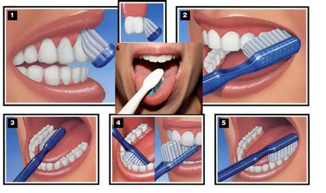 طريقة تفريش الاسنان